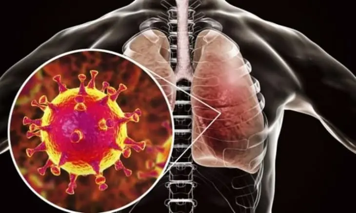 Qanday parhez koronavirus asoratlari xavfini 40 foizga kamaytiradi