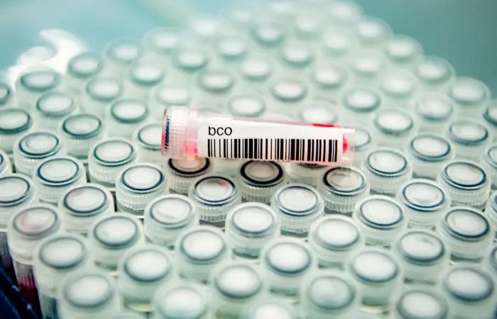 Xitoy koronavirus manbasini aniqlash uchun Uxandagi minglab qon namunalarini o‘rganadi