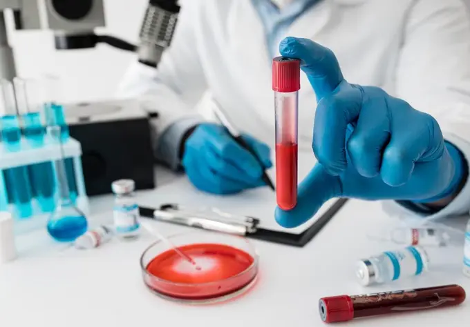 В Казахстане пытаются ликвидировать очаг сибирской язвы