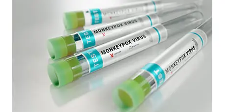 Russia to supply Uzbekistan with monkeypox test systems following EAEU meeting 