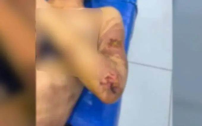 В Джизаке завели уголовное дело на родственников, которые пытали и удерживали сноху